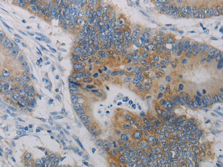 CD303 Polyclonal Antibody Store at -20°C