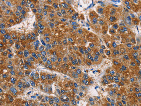 APLNR Polyclonal Antibody Store at -20°C