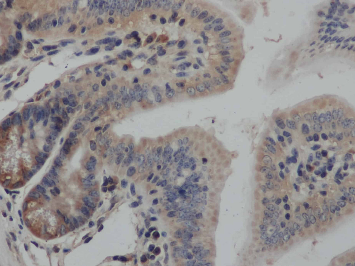 SMAD3 Polyclonal Antibody Store at -20°C