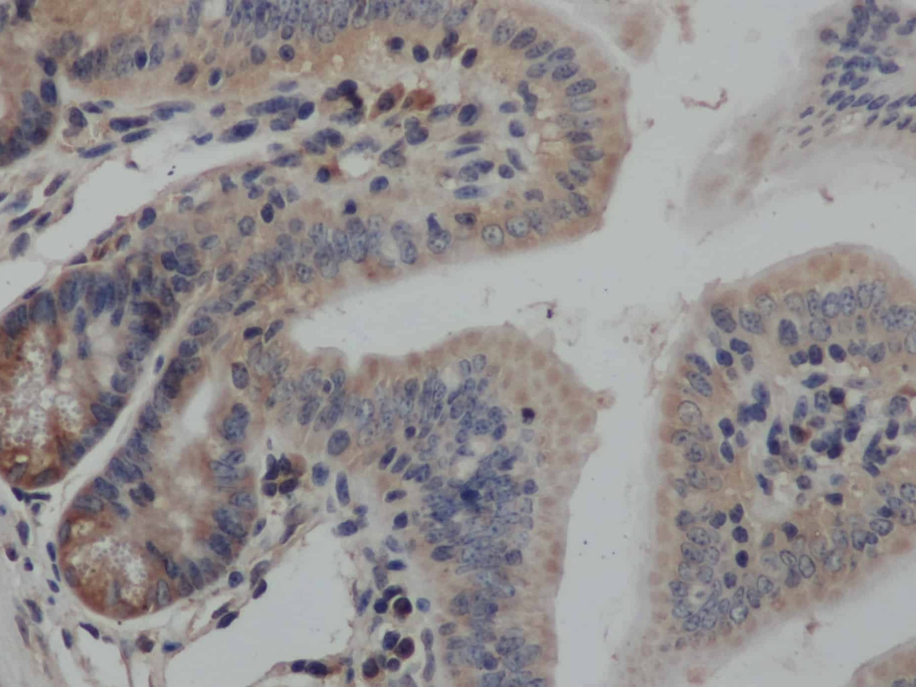 SMAD3 Polyclonal Antibody Store at -20°C