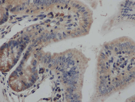 SMAD3 Polyclonal Antibody Store at -20°C