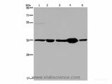 LZTFL1 Polyclonal Antibody Store at -20°C