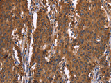 HINT1 Polyclonal Antibody Store at -20°C