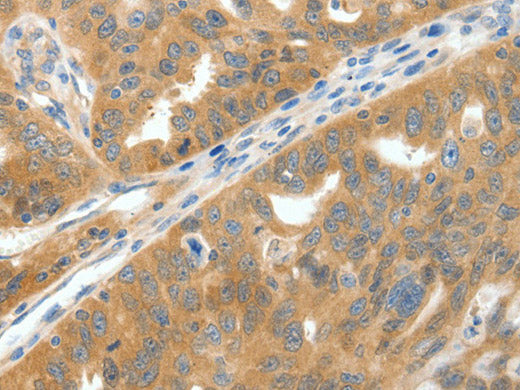 SCN9A Polyclonal Antibody Store at -20°C