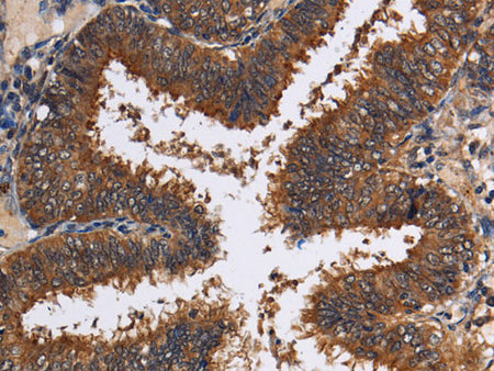 LRRC57 Polyclonal Antibody