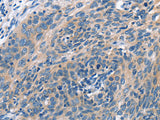 CUL7 Polyclonal Antibody
