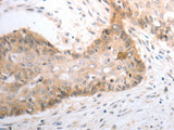 SLC1A4 Polyclonal Antibody