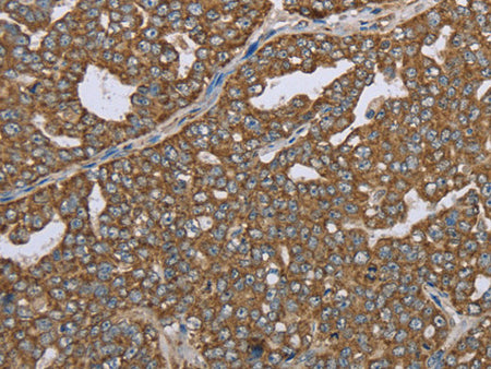 CERS4 Polyclonal Antibody Store at -20°C
