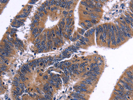 NFATC3 Polyclonal Antibody Store at -20°C