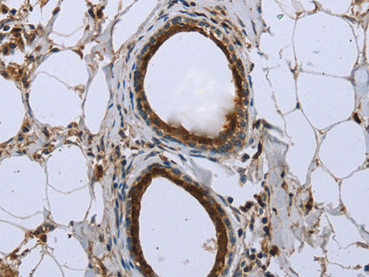 FBP1 Polyclonal Antibody Store at -20°C