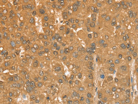 CXCR4 Polyclonal Antibody Store at -20°C
