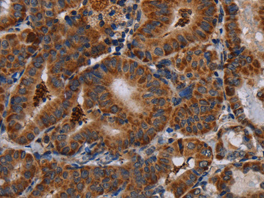DISC1 Polyclonal Antibody Store at -20°C
