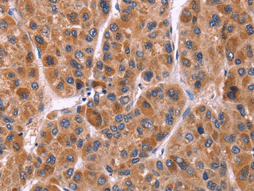 Ephrin A5 Polyclonal Antibody Store at -20°C