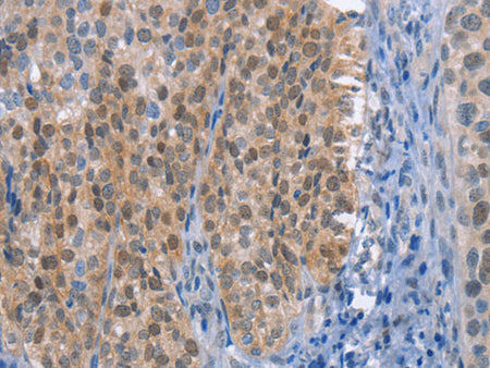 UCK1 Polyclonal Antibody