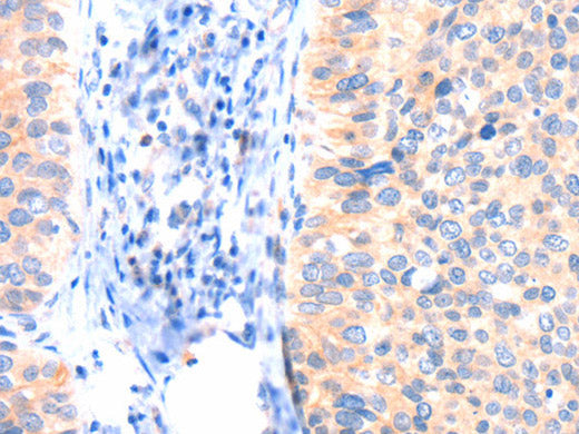 ANK3 Polyclonal Antibody Store at -20°C