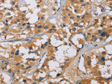 NME5 Polyclonal Antibody