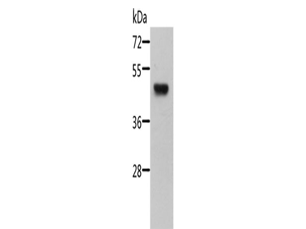 STRADB Polyclonal Antibody Store at -20°C