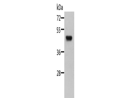 STRADB Polyclonal Antibody Store at -20°C