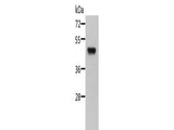 STRADB Polyclonal Antibody Store at -20°C