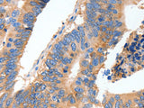 MUC6 Polyclonal Antibody