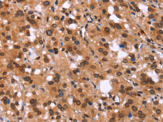 GPR124 Polyclonal Antibody Store at -20°C