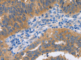 NBEA Polyclonal Antibody