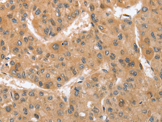 ATG12 Polyclonal Antibody Store at -20°C