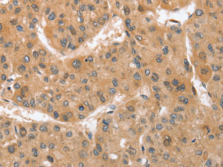 ATG12 Polyclonal Antibody Store at -20°C