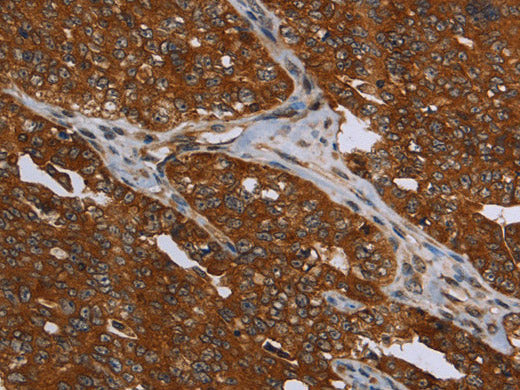 MCHR1 Polyclonal Antibody Store at -20°C
