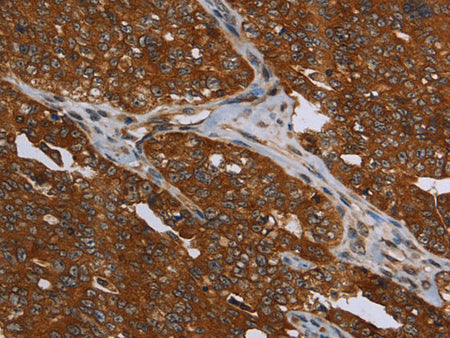 MCHR1 Polyclonal Antibody Store at -20°C
