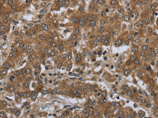 GABRB1 Polyclonal Antibody Store at -20°C