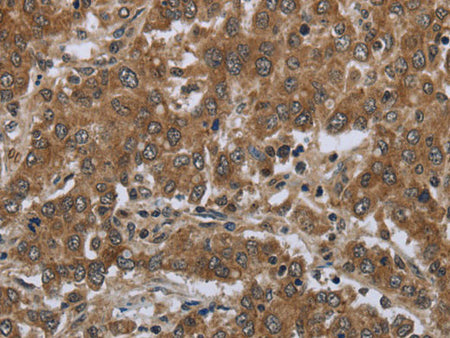 GABRB1 Polyclonal Antibody Store at -20°C