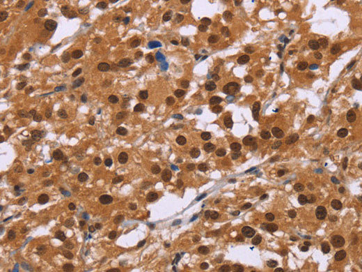 CTNNBL1 Polyclonal Antibody Store at -20°C