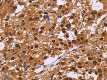 CTNNBL1 Polyclonal Antibody Store at -20°C