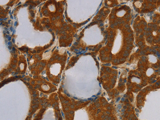 PARP3 Polyclonal Antibody Store at -20°C