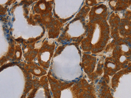 PARP3 Polyclonal Antibody Store at -20°C