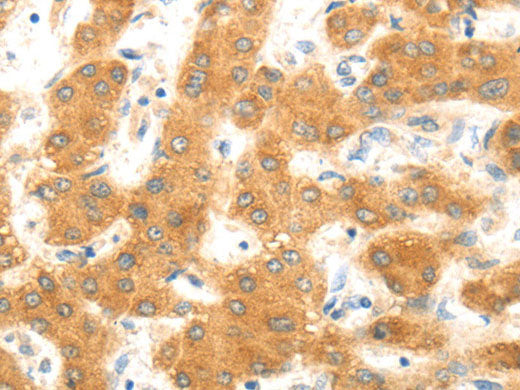 MAP2K6 Polyclonal Antibody Store at -20°C