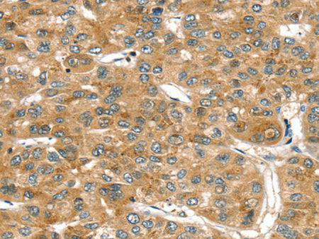 RASSF9 Polyclonal Antibody Store at -20°C