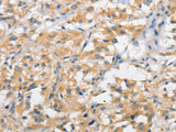 ATG10 Polyclonal Antibody Store at -20°C