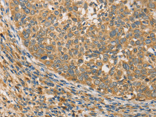 ATG3 Polyclonal Antibody Store at -20°C