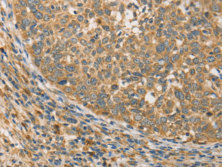 ATG3 Polyclonal Antibody Store at -20°C