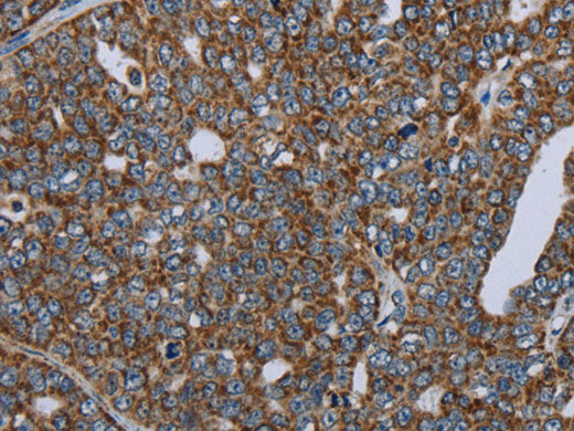 NDUFA13 Polyclonal Antibody Store at -20°C
