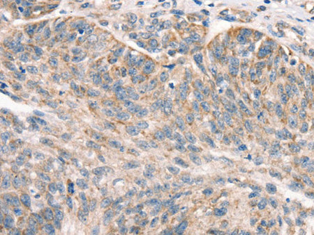 DECR1 Polyclonal Antibody Store at -20°C