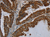 HSD17B2 Polyclonal Antibody Store at -20°C