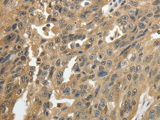 GSR Polyclonal Antibody Store at -20°C