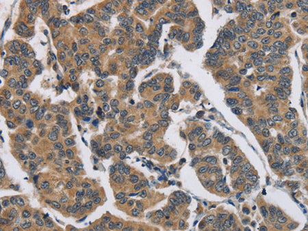 DHRS3 Polyclonal Antibody Store at -20°C
