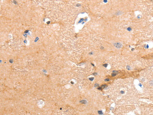 GPR64 Polyclonal Antibody