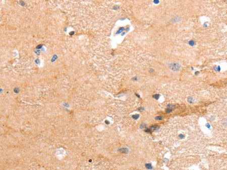 GPR64 Polyclonal Antibody