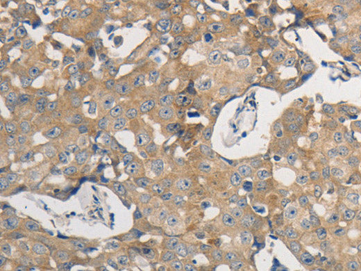PPP2CB Polyclonal Antibody Store at -20°C