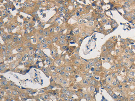 PPP2CB Polyclonal Antibody Store at -20°C